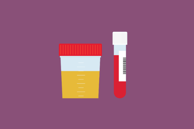illustration of a vial of blood and cup of urine